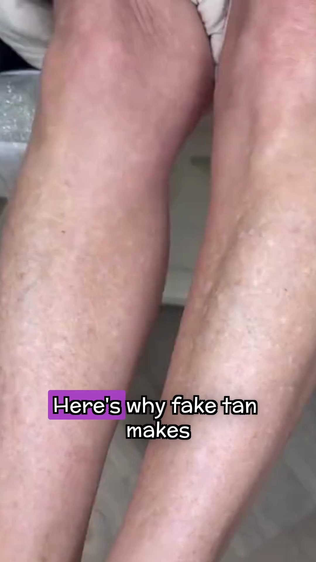 Miracle de Paris Facebook ad: Why Fake Tan Makes Sun Damage WORSE (The DHA Problem…