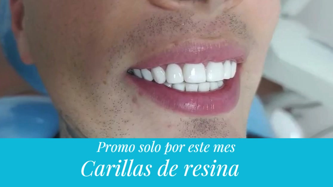 Odontología Delatorre Facebook ad from Jul 7, 2026