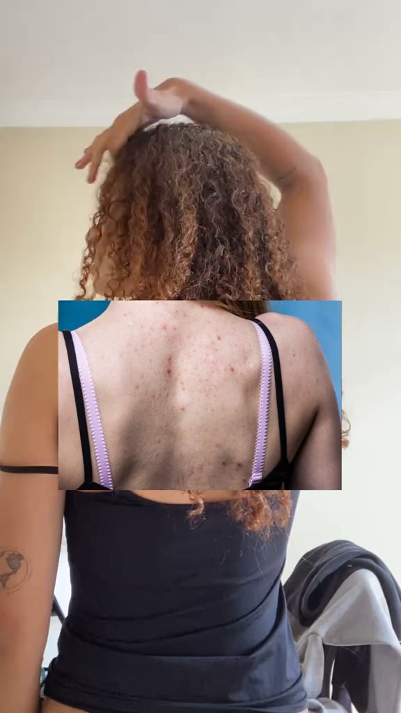 Cicatribem Facebook ad: Você merece esse cuidado