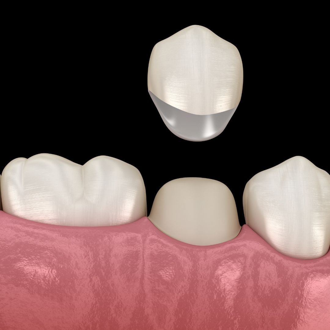 Aesthetic Family Dentistry Facebook ad