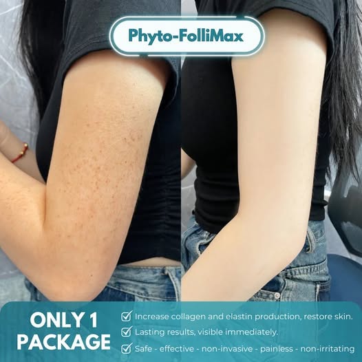 Cebu Phytocare Skin Clinic Facebook ad