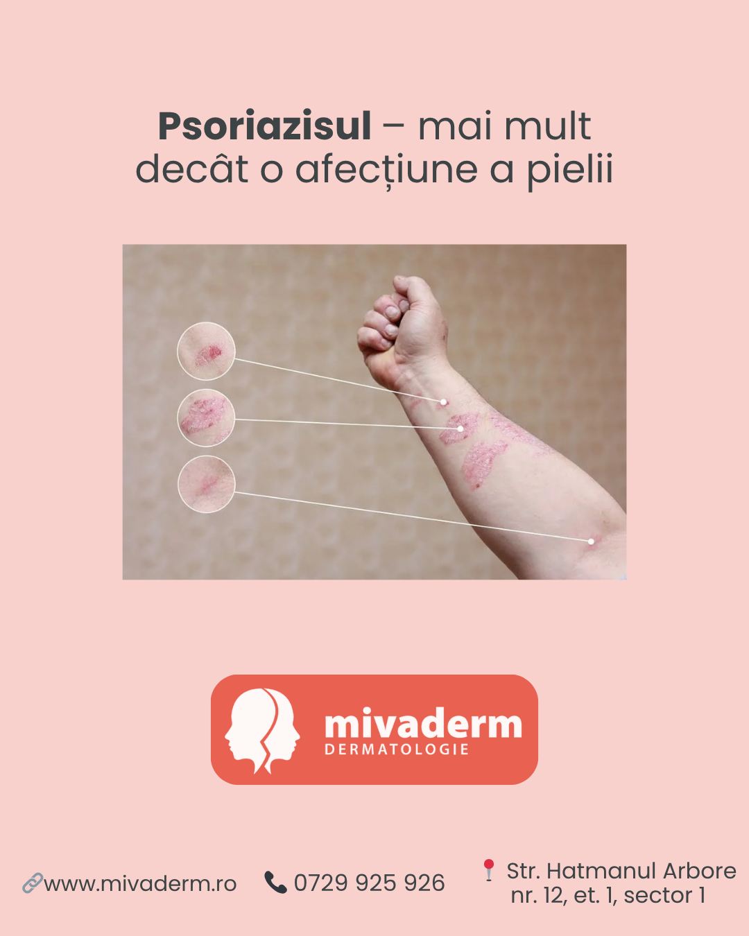 Mivaderm Facebook ad