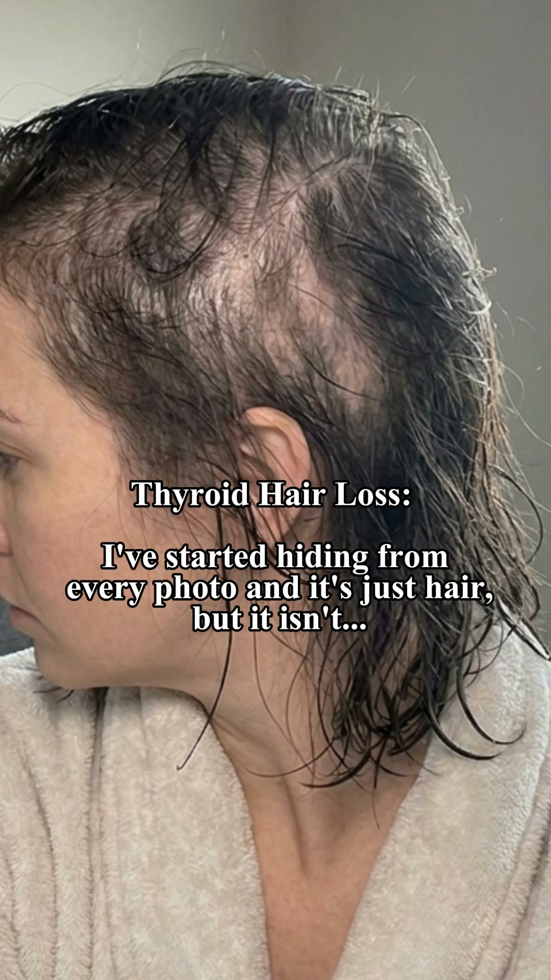 Bloom & Bond Facebook ad: Treating Your Thyroid Won't Bring Your Hair Back