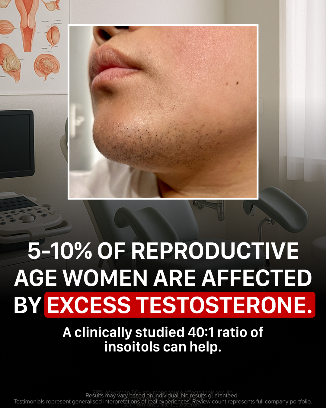 URO Facebook ad