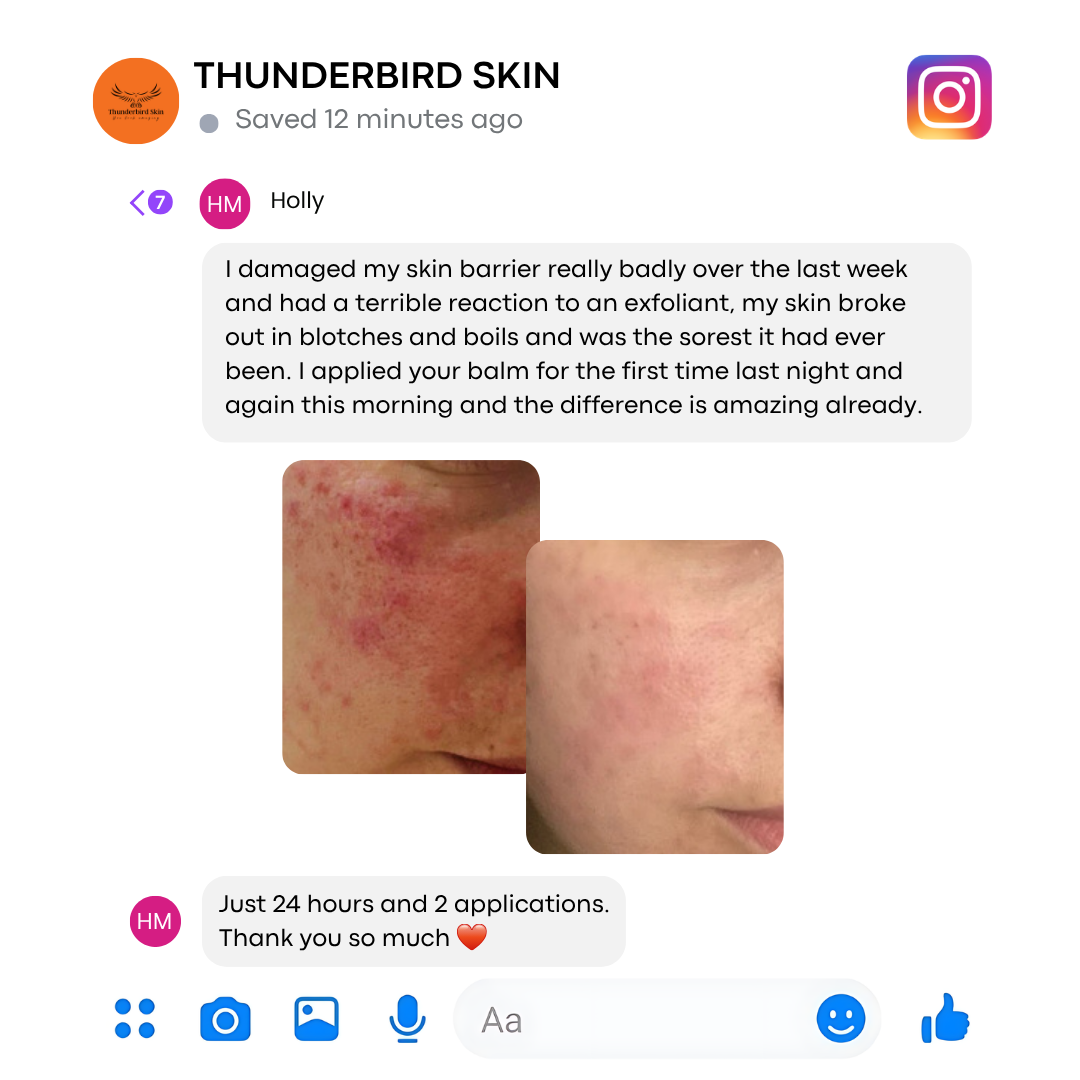 Thunderbird Natural Skincare - sensitive skin solutions Facebook ad