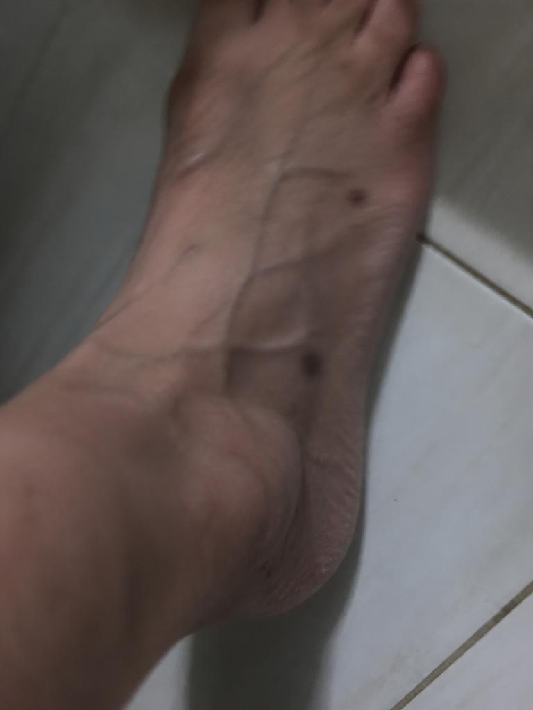 Seriatu Facebook ad: Podiatrist: Rest and stretch is the worst advice for foot…