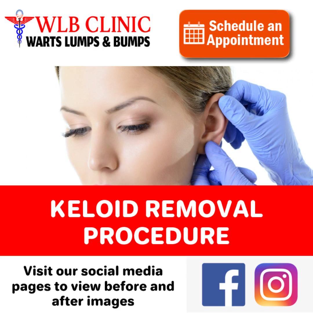 Warts, Lumps and Bumps Clinic Facebook ad