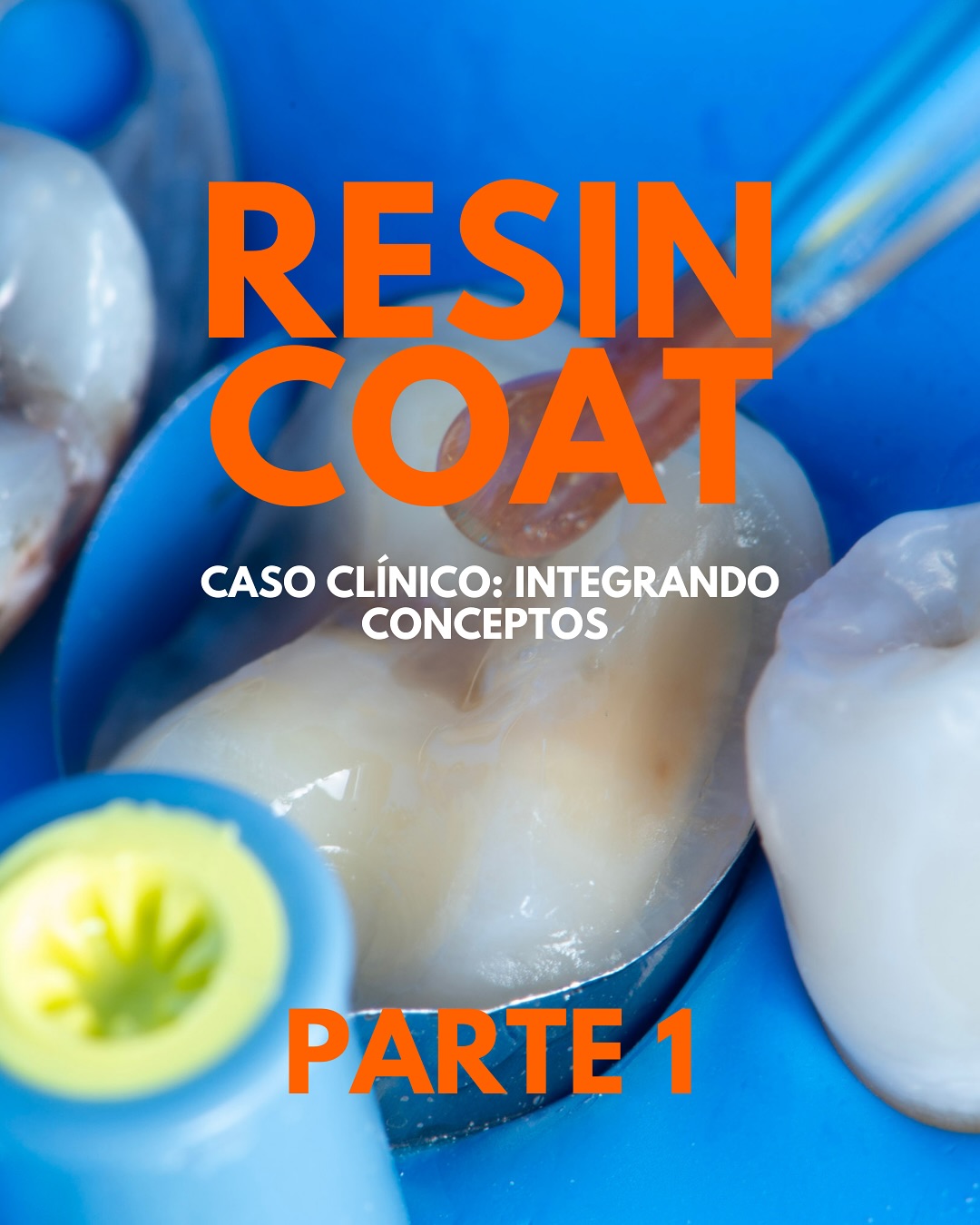 Dr. Celso Gutiérrez Halabí Facebook ad: RESIN COAT: Caso clínico paso a paso PARTE…