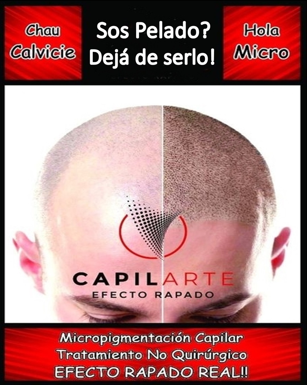 Capilarte Efecto Rapado Facebook ad: Solicitá tu presupuesto y cambiá tu vida!