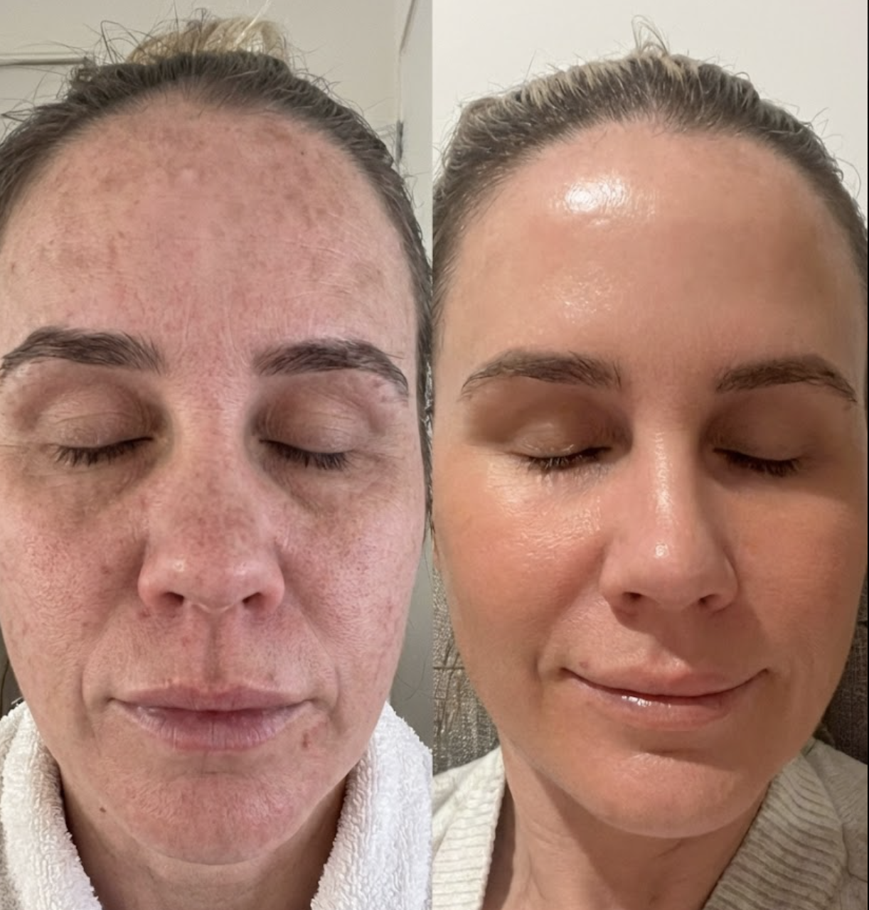 Rachel Malone Facebook ad: Struggling with dull skin? Read this.