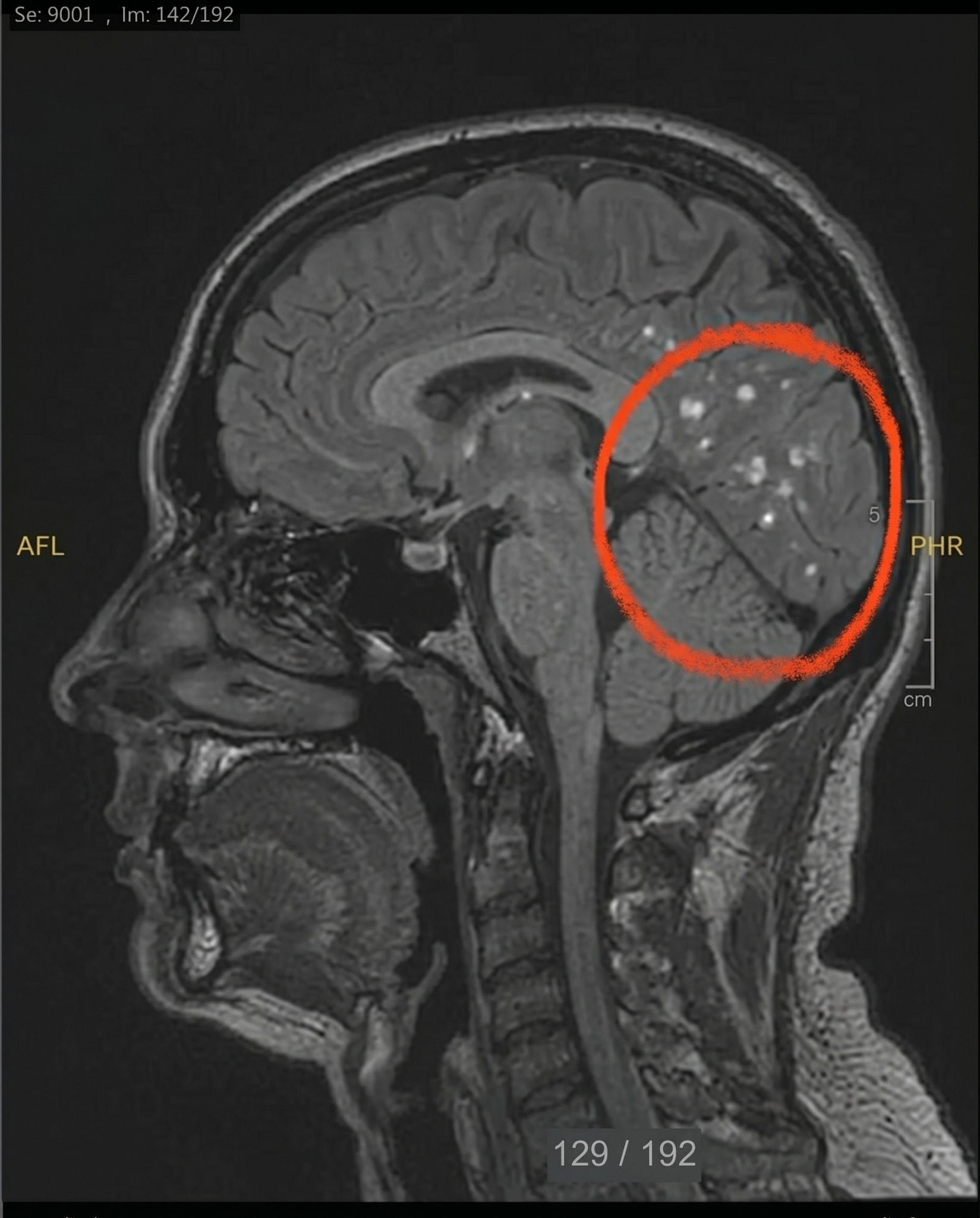 The Migraine Nightshift Report Facebook ad