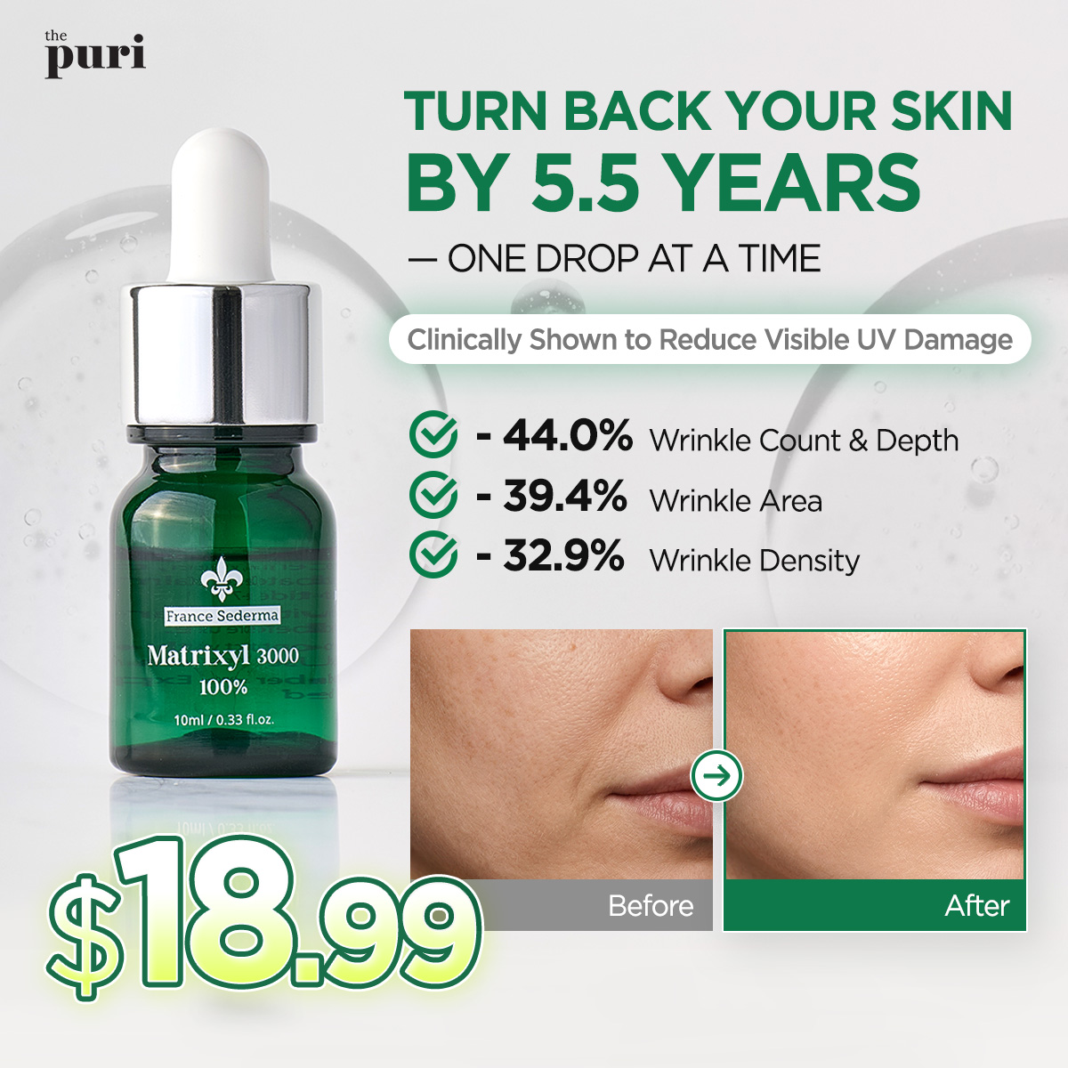 Thepuri Facebook ad: Matrixyl 3000 100% Peptide Serum