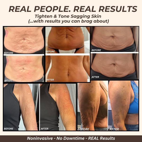 skinclinicmbl Facebook ad: Laser Skin Tightening & Fat Reduction From Just £199