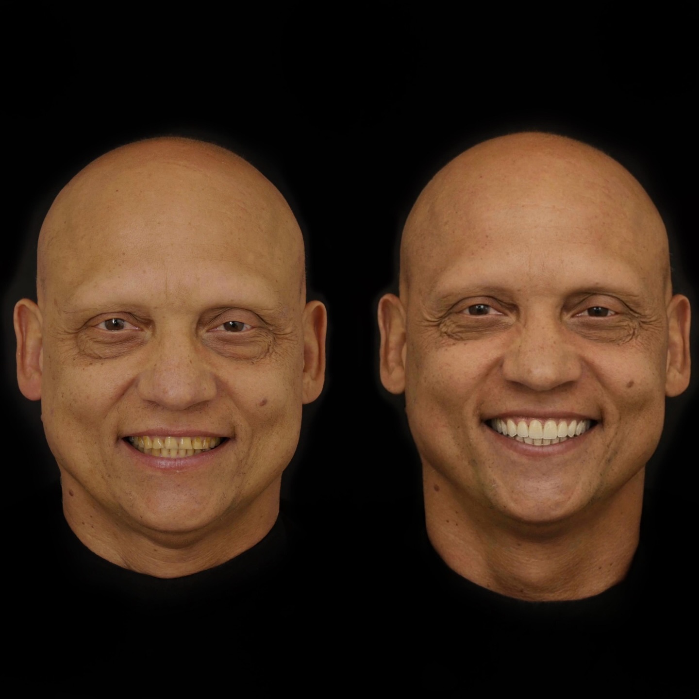 Rildo Lasmar Odontologia e Estética Facebook ad