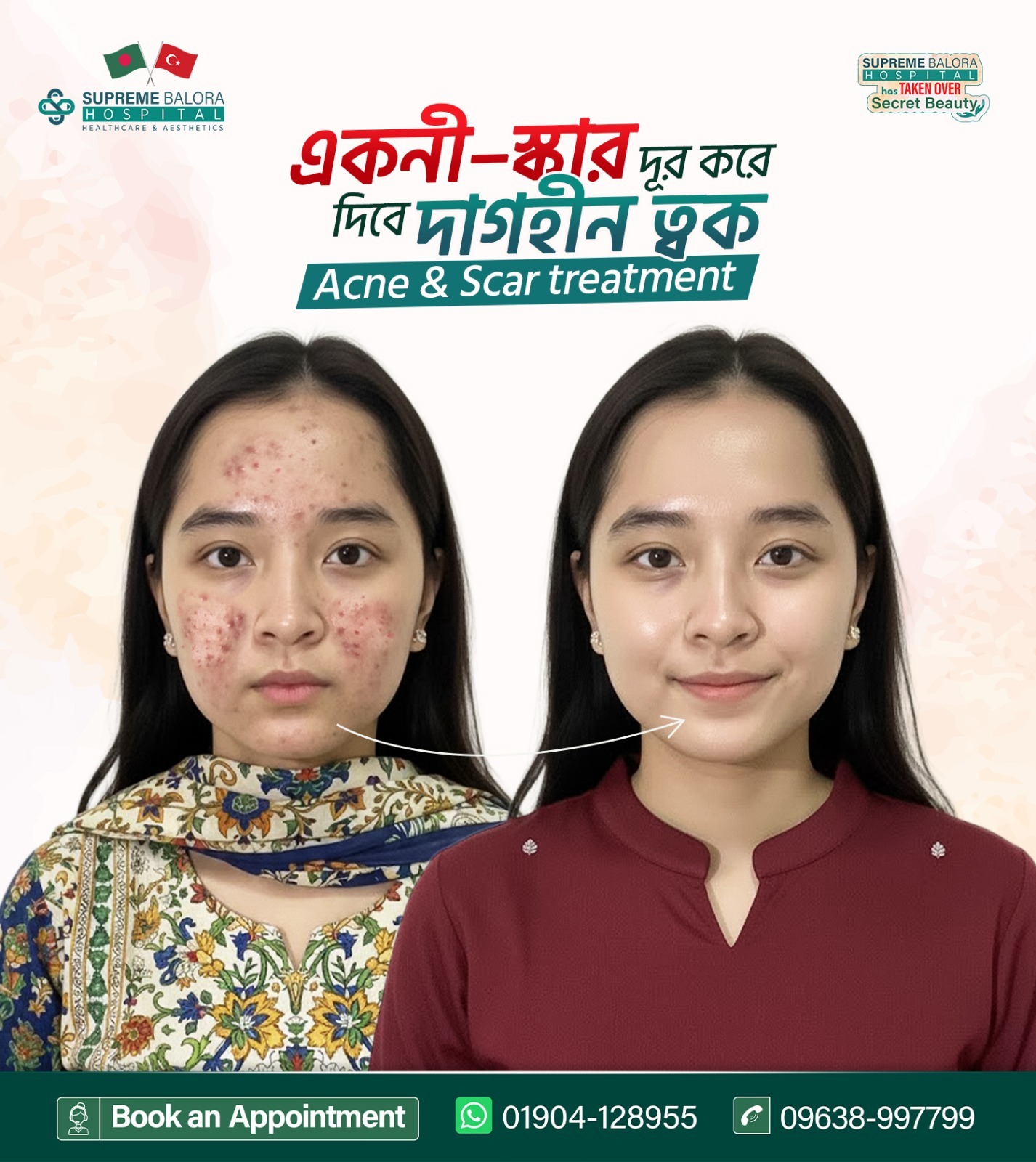 Supreme Balora Hospital Aesthetics Care Facebook ad: পুরনো ব্রণের দাগ নিয়ে চিন্তিত? সঠিক সমাধান জানুন