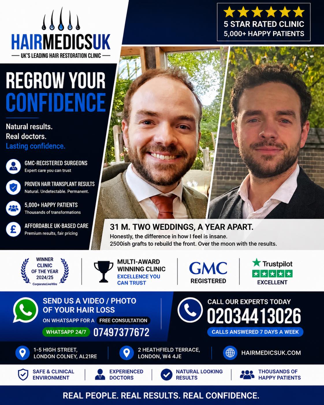 Hair Medics UK Facebook ad: Hair Medics UK | FUE Hair Transplants | Hair Loss Clinic