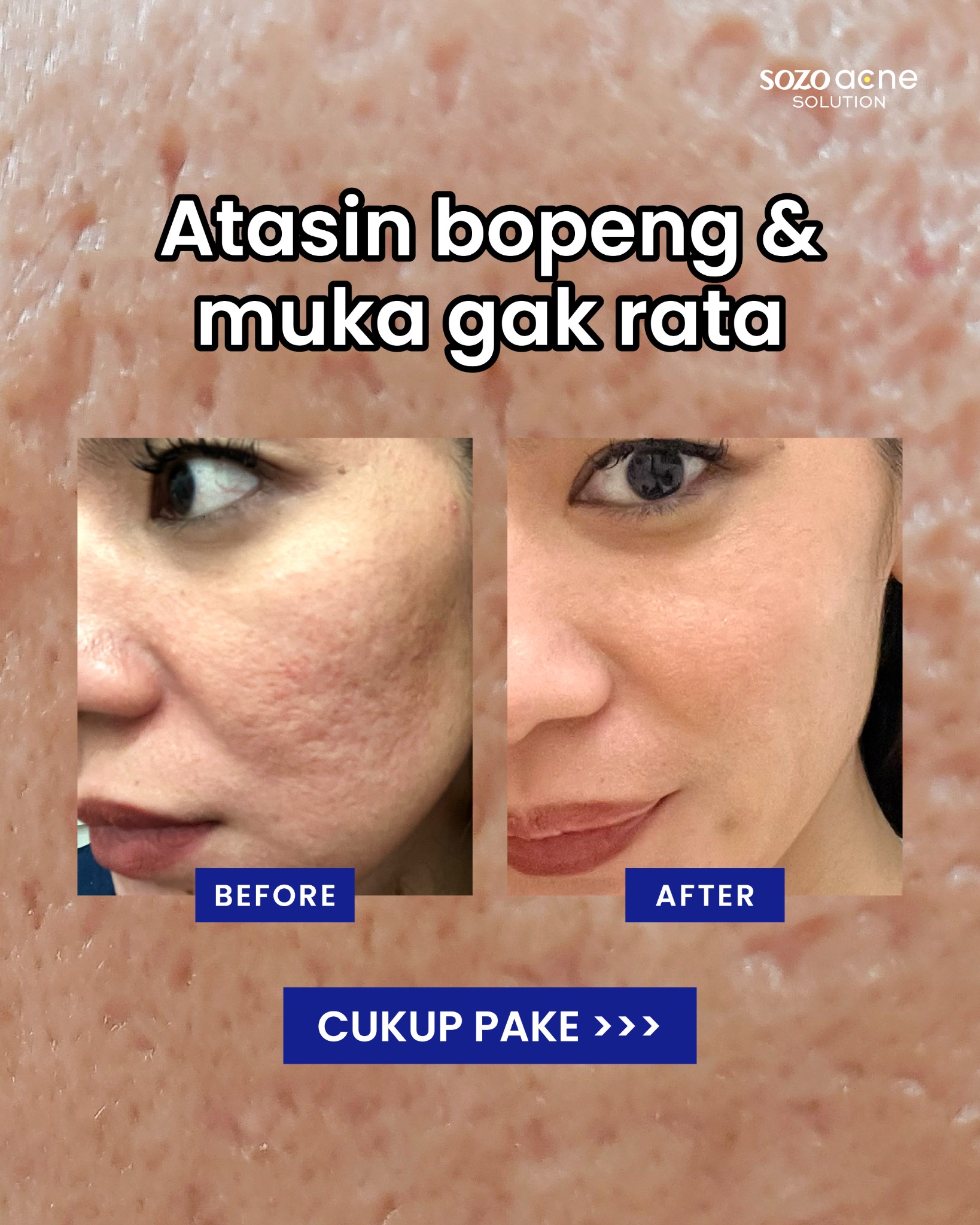 Sozo Skin Clinic Facebook ad