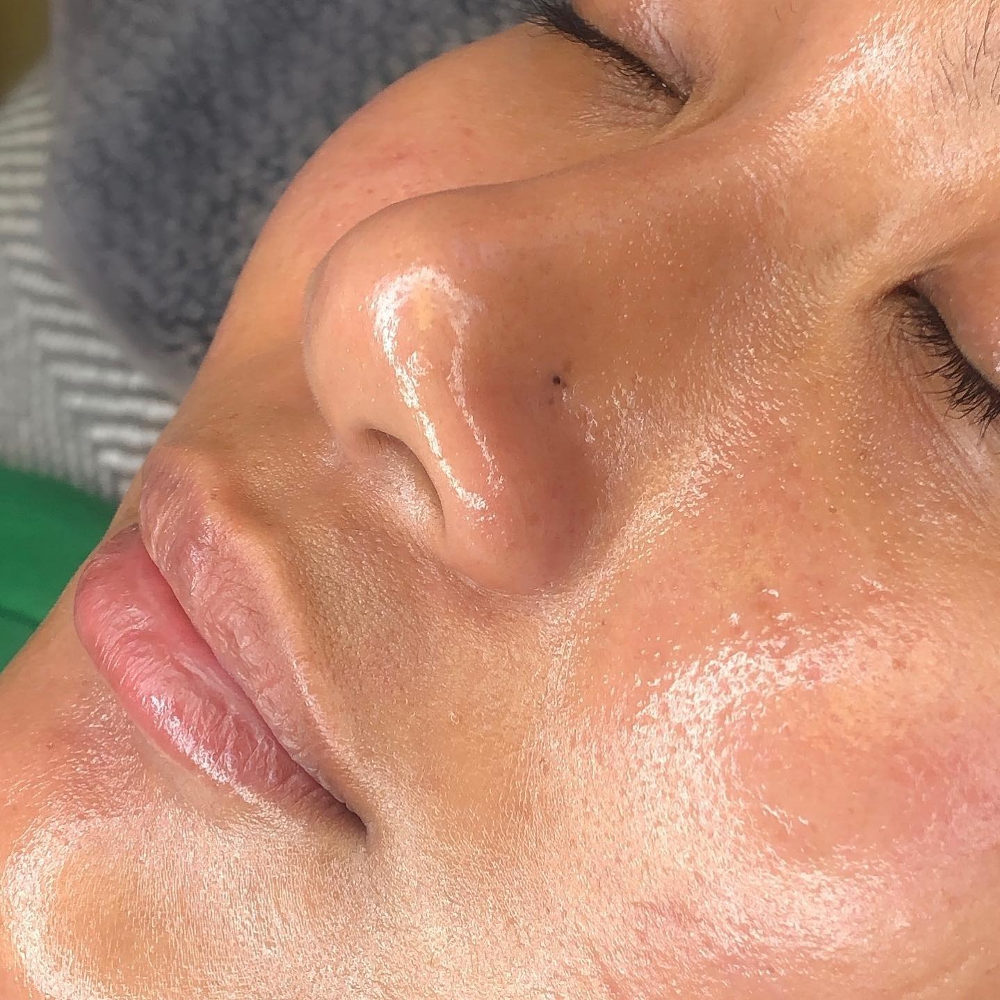 Model Standards Facebook ad: Advanced Skincare Treatment Models Needed Next Week