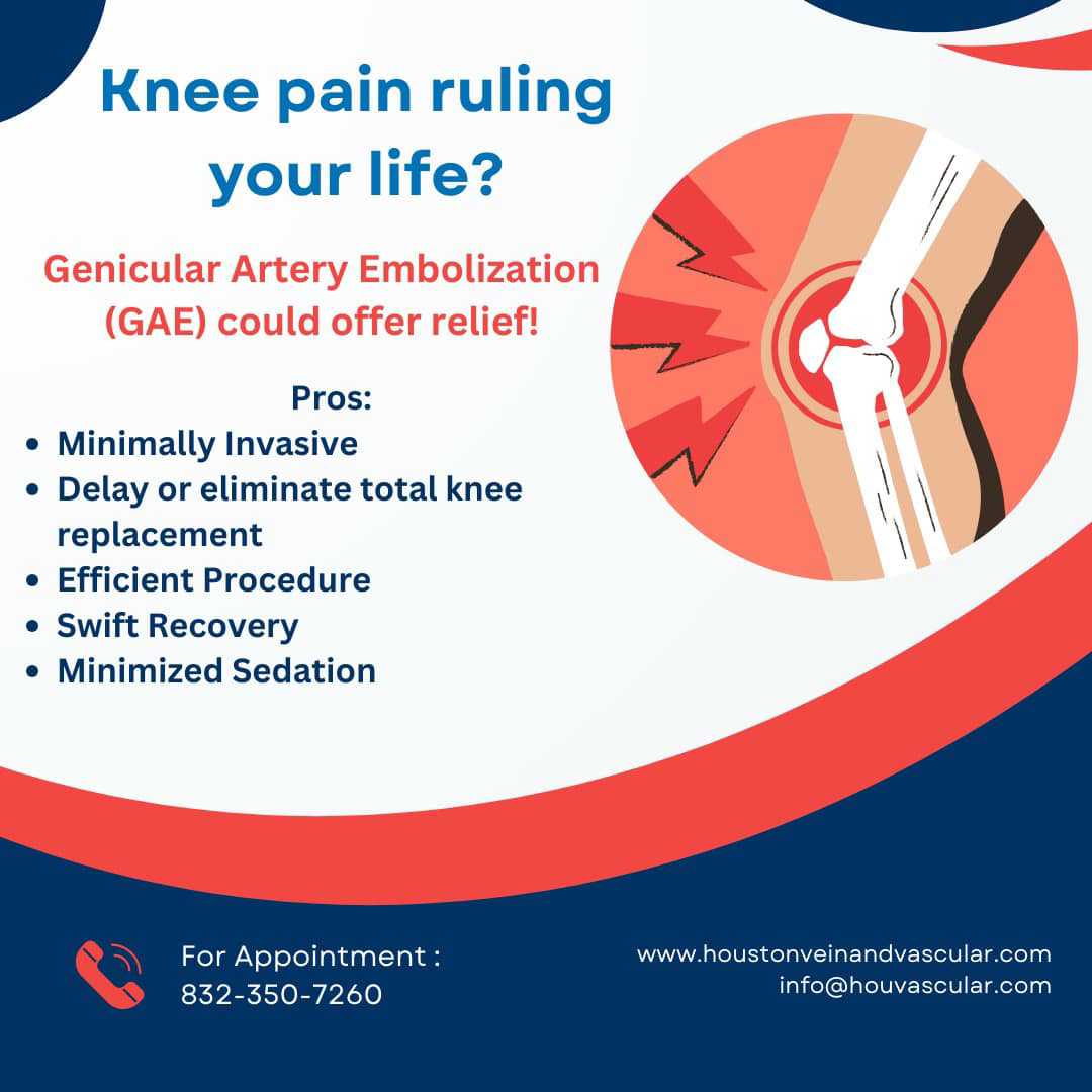 Houston Vein and Vascular Facebook ad: GAE the new treatment for knee arthritis