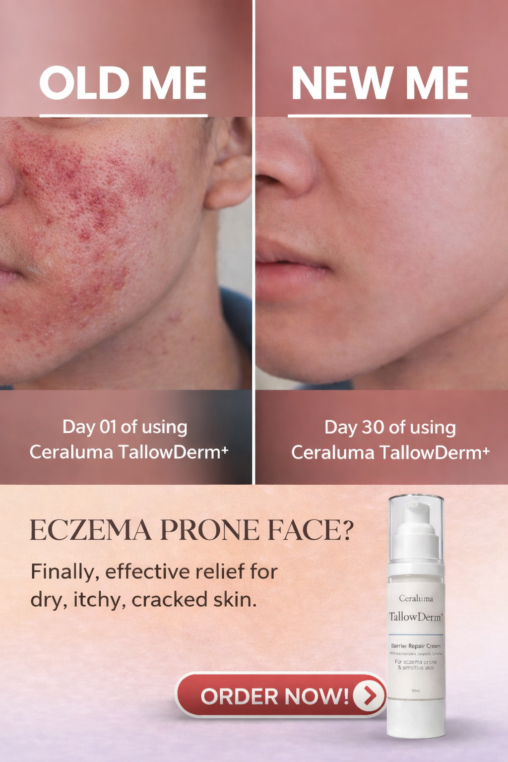 Ceraluma TallowDerm+ Facebook ad