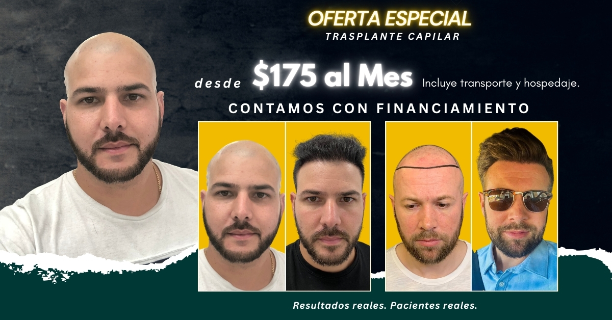 Hair Transplant Design Facebook ad