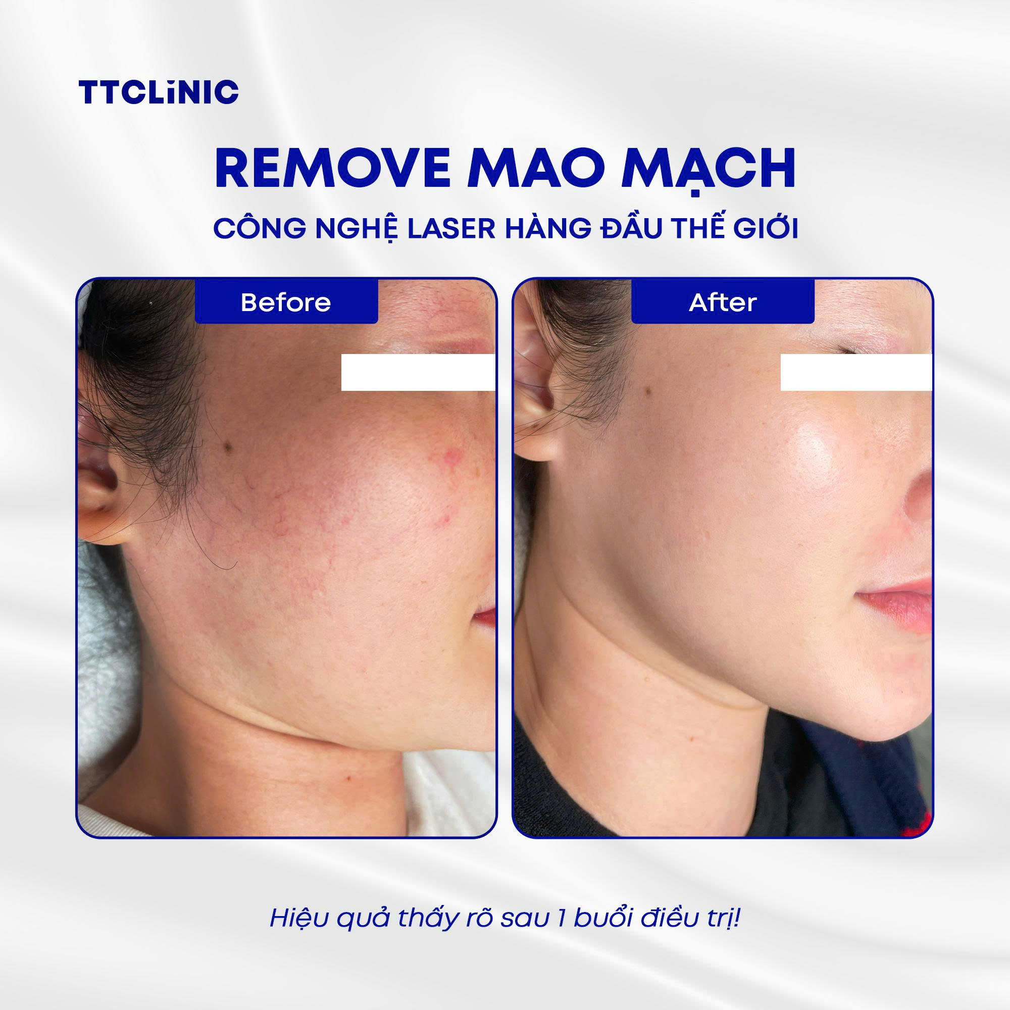 TTCLiNIC Facebook ad