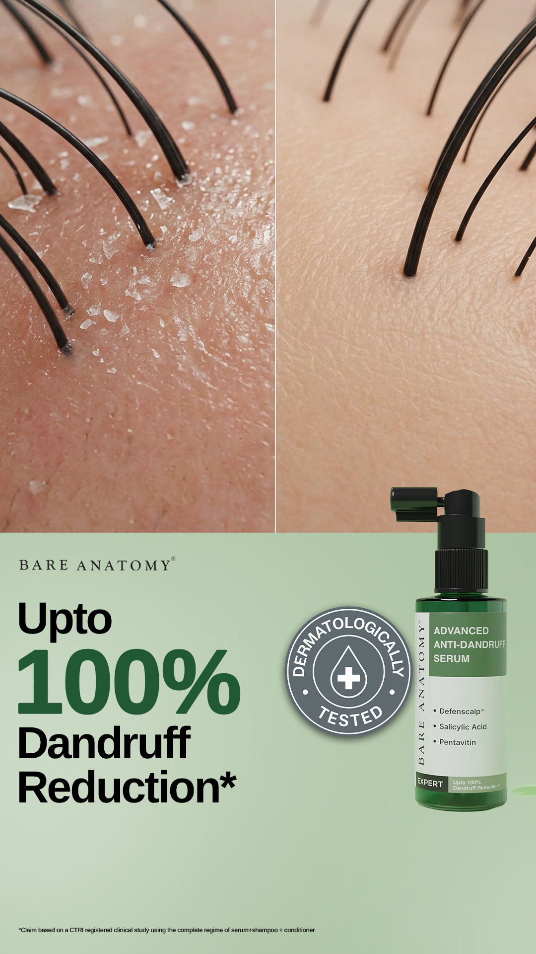 Bare Anatomy Facebook ad