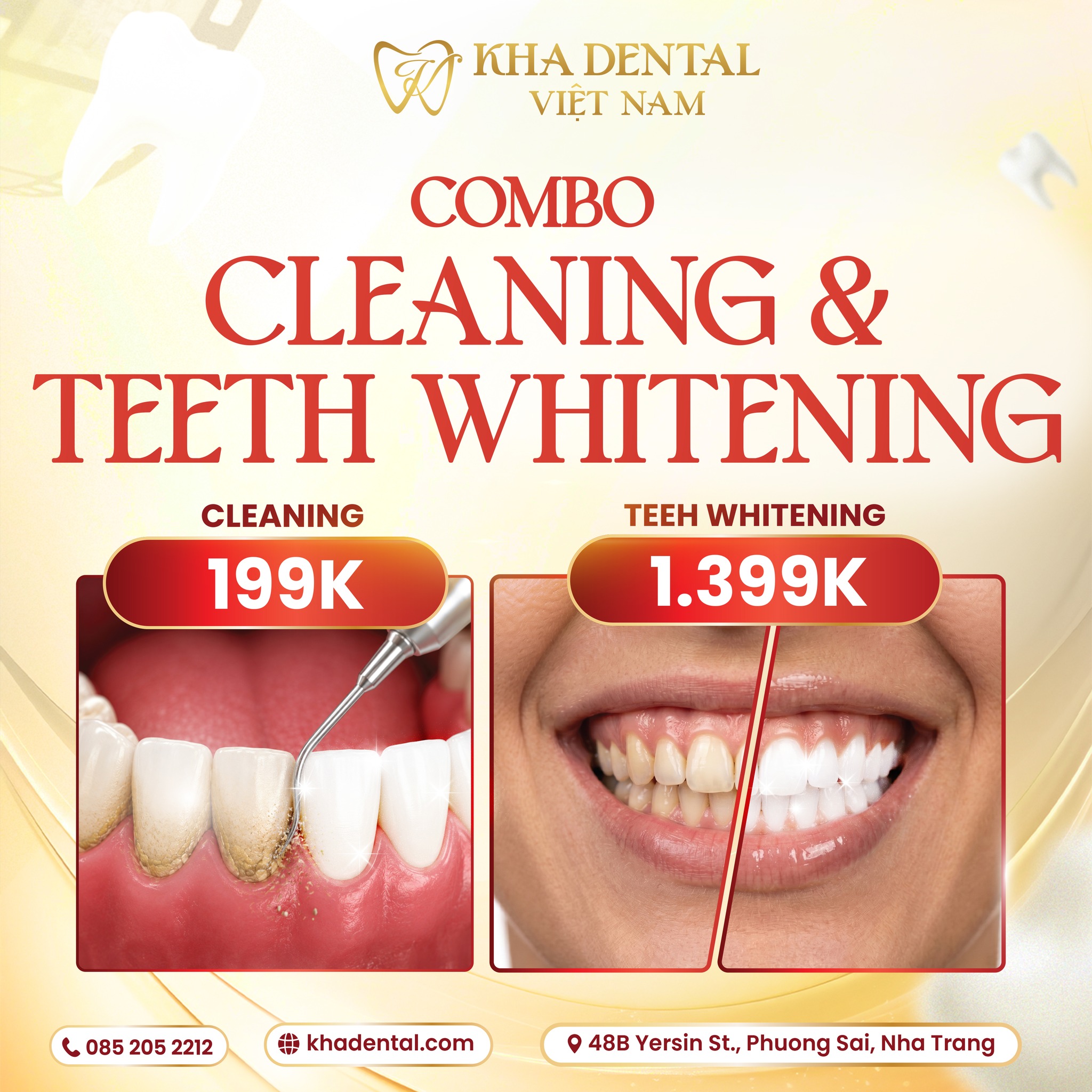Kha Dental Nha Trang Facebook ad: DENTAL CLEANING & TEETH WHITENING