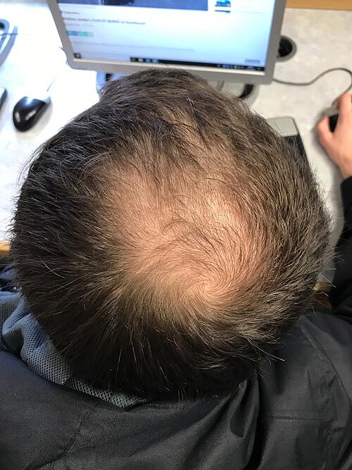 Honest Hair Reviews Facebook ad: Stop Thinning Before It Gets Worse