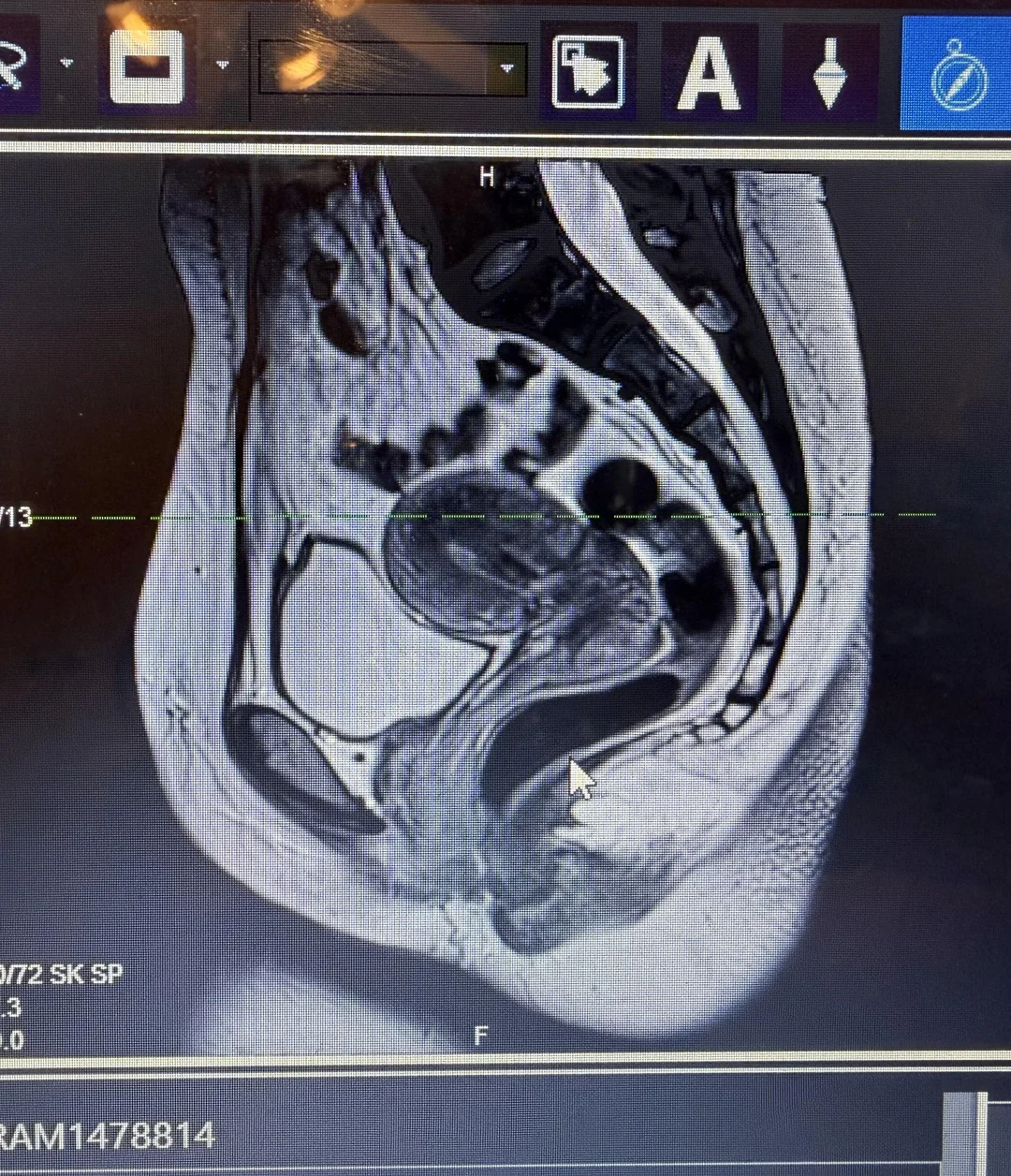 The Migraine Nightshift Report Facebook ad