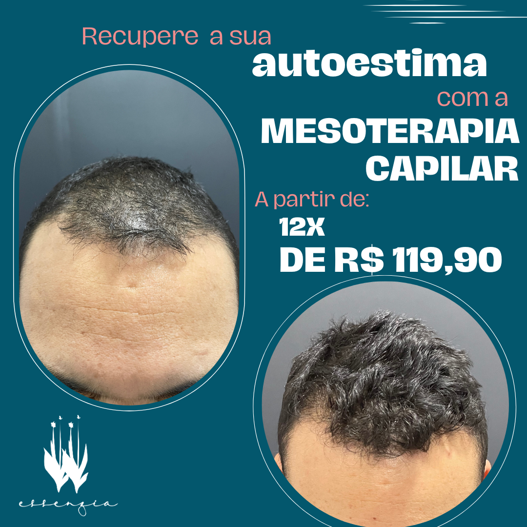 Clinica Essenzia Cachoeirinha Facebook ad: Fale conosco agora mesmo