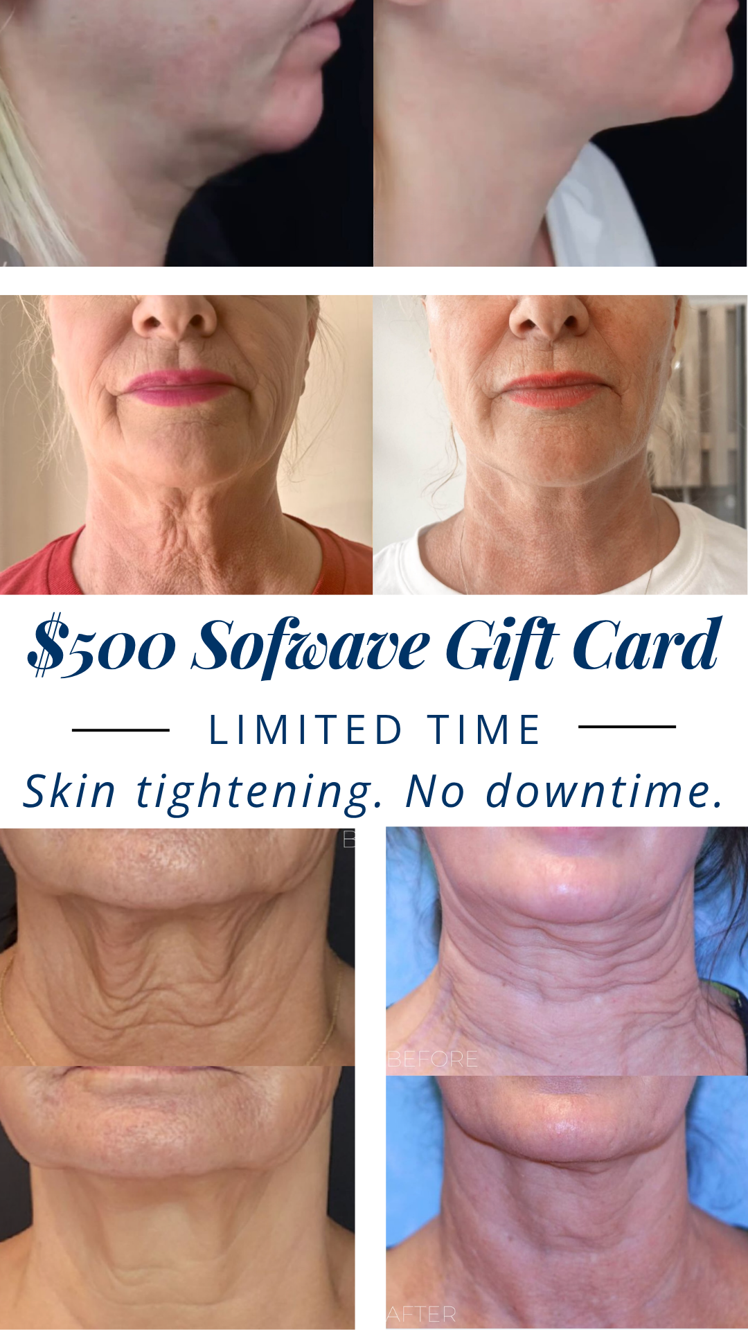 VIO Med Spa - Delray Beach Facebook ad from Apr 15, 2026