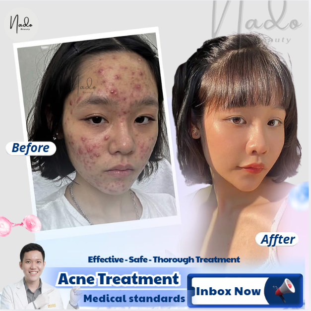 Nado Beauty Abu Dhabi Facebook ad