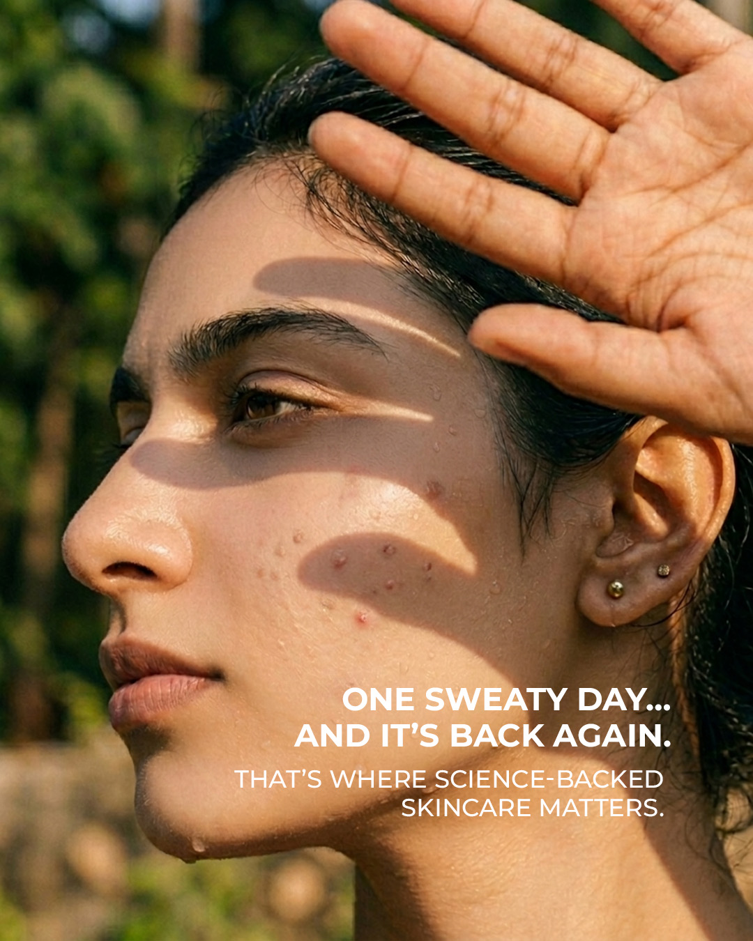 AcneStar Facebook ad: Summer breakouts start beneath the surface.