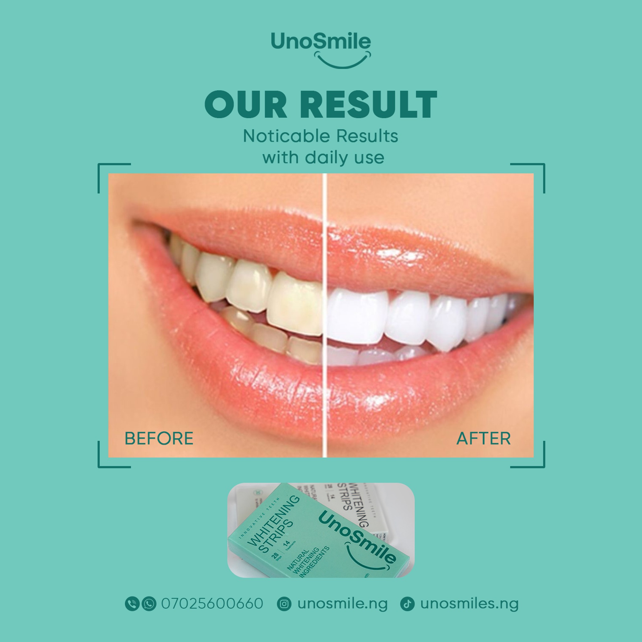 UnoSmile Facebook ad: Fix Yellow Teeth Fast