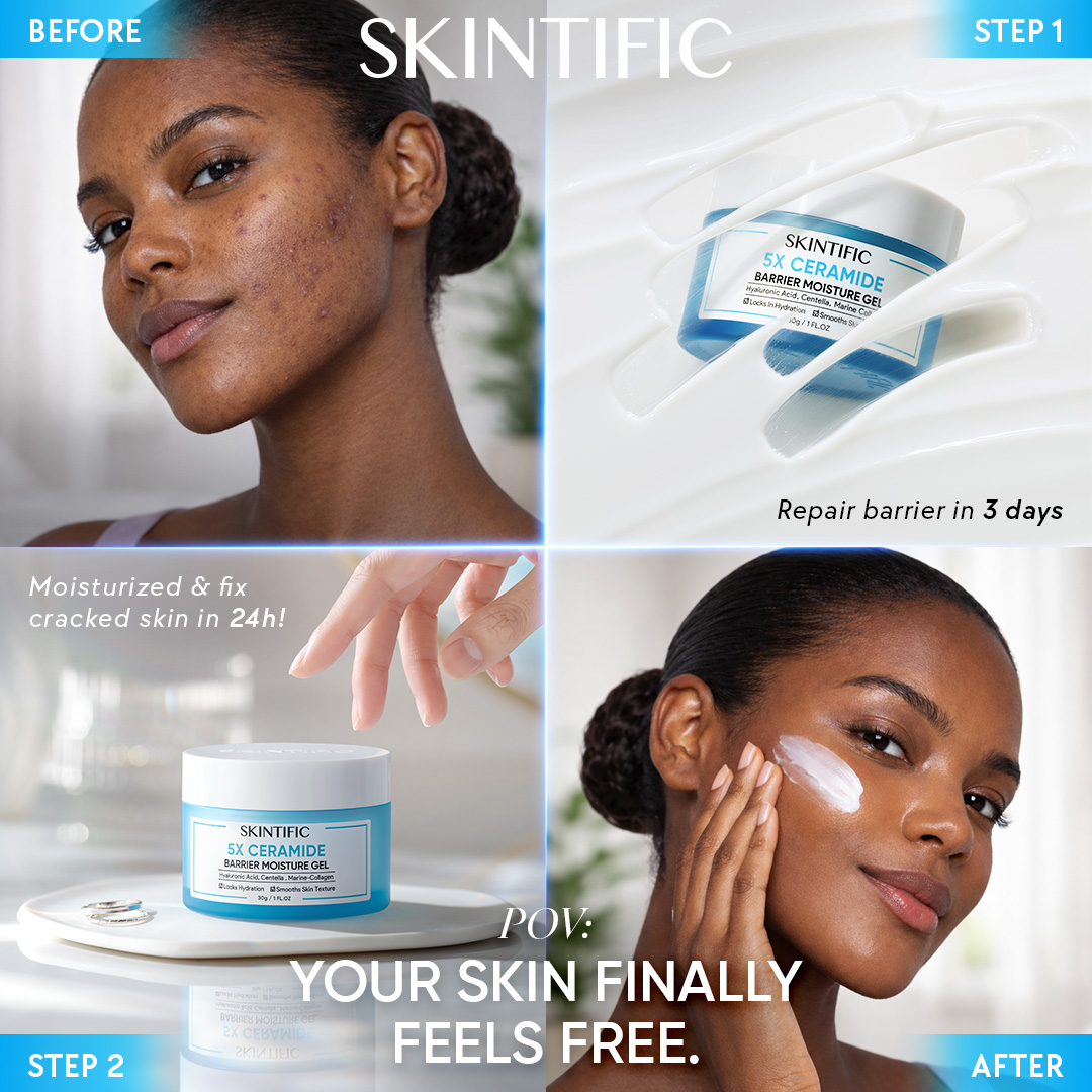 SkintificShop Facebook ad