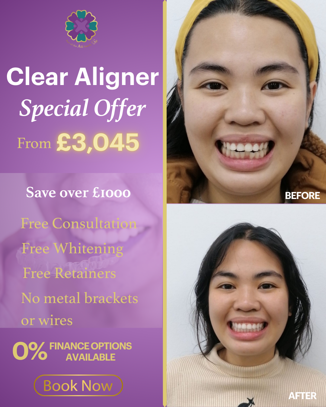 Bredbury Dental Centre Facebook ad