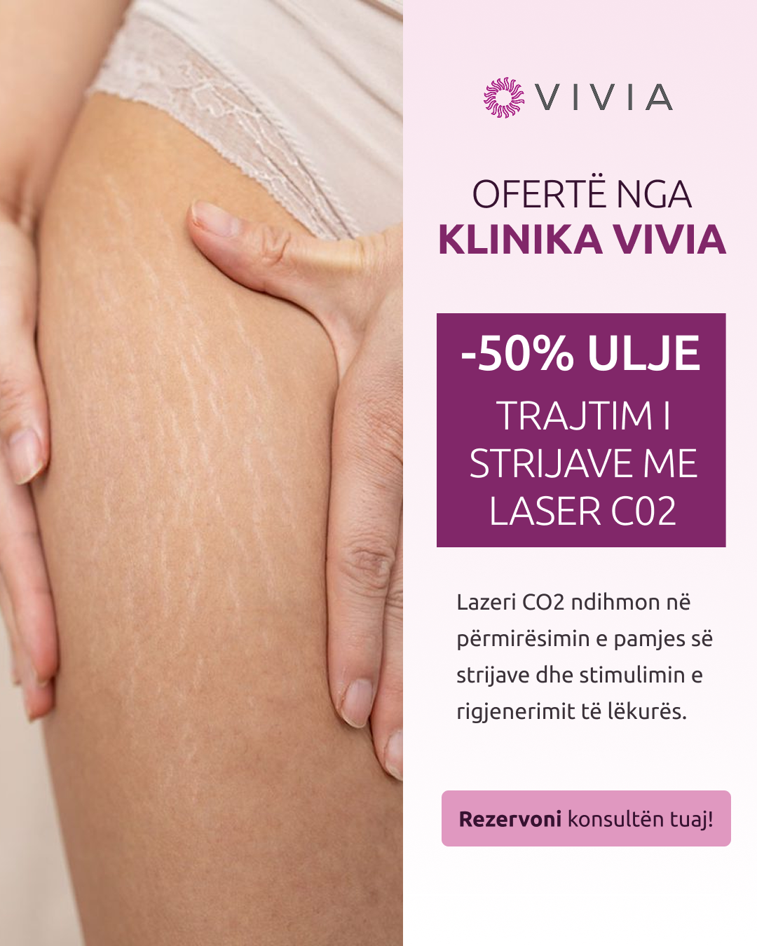 Klinika Vivia Facebook ad: Kontakto tani!