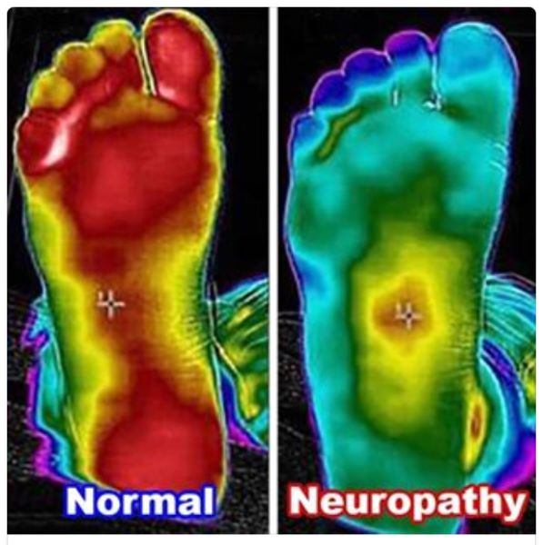 Horseshoe Bay Chiropractic Facebook ad: FREE Neuropathy Consultation, State-of-the-Art Nerve Scan…