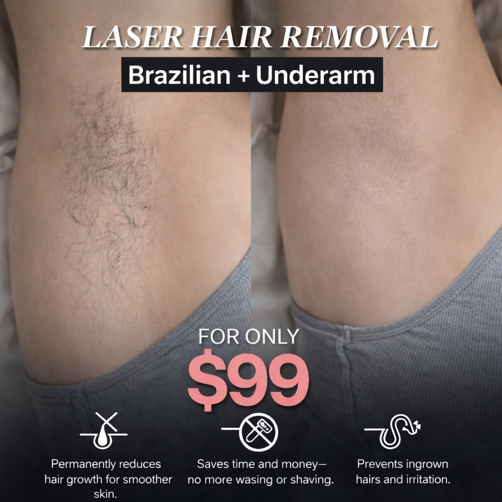 Maryam C Beauté Facebook ad: Limited Time Offer - Laser Hair Removal