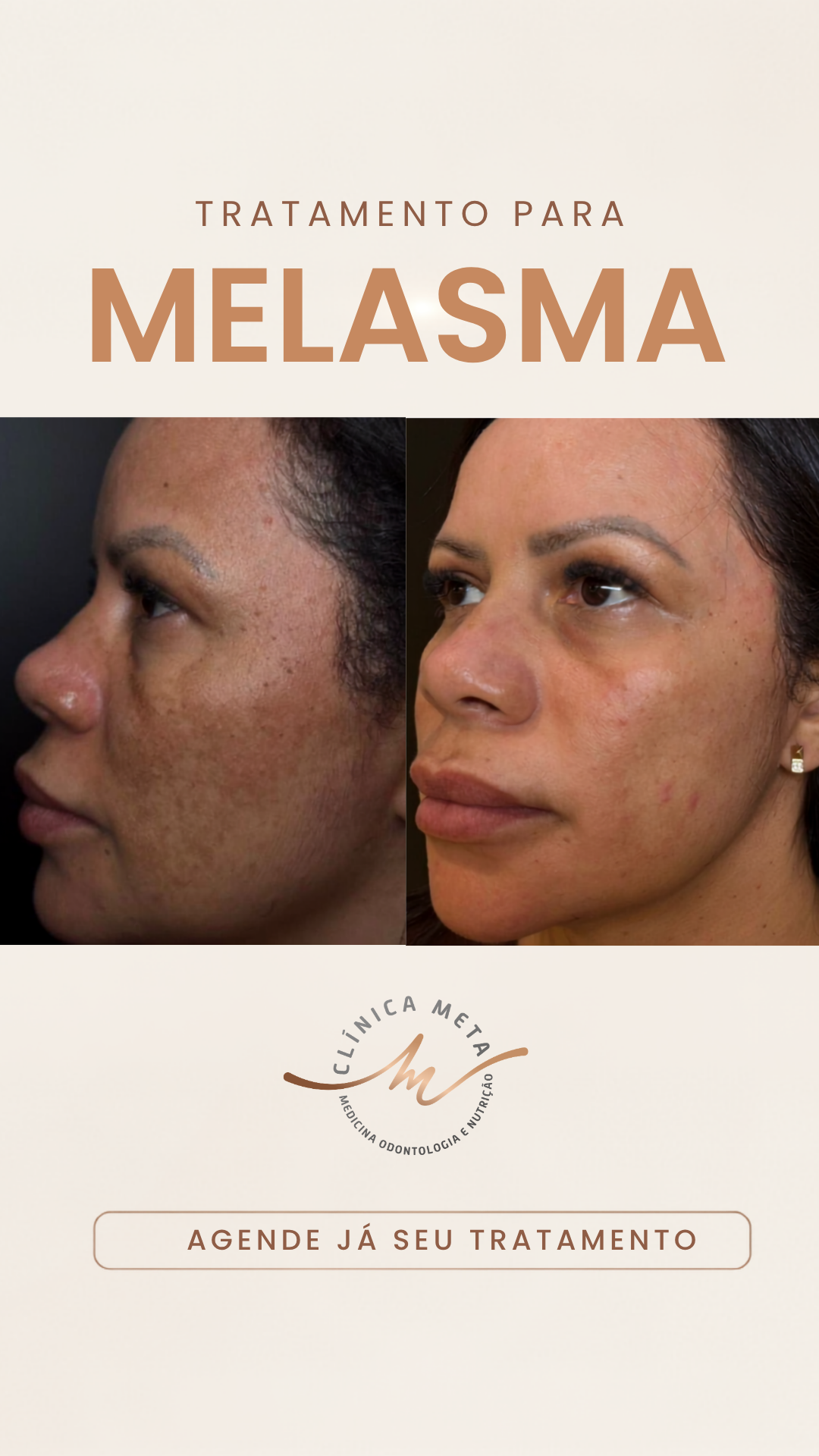 Clínica META - Medicina Integrativa e Estética Facebook ad from Jul 6, 2026