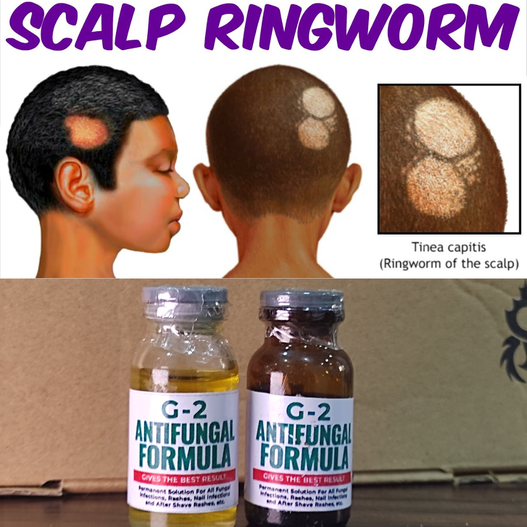 Fungal Natural Remedy Facebook ad