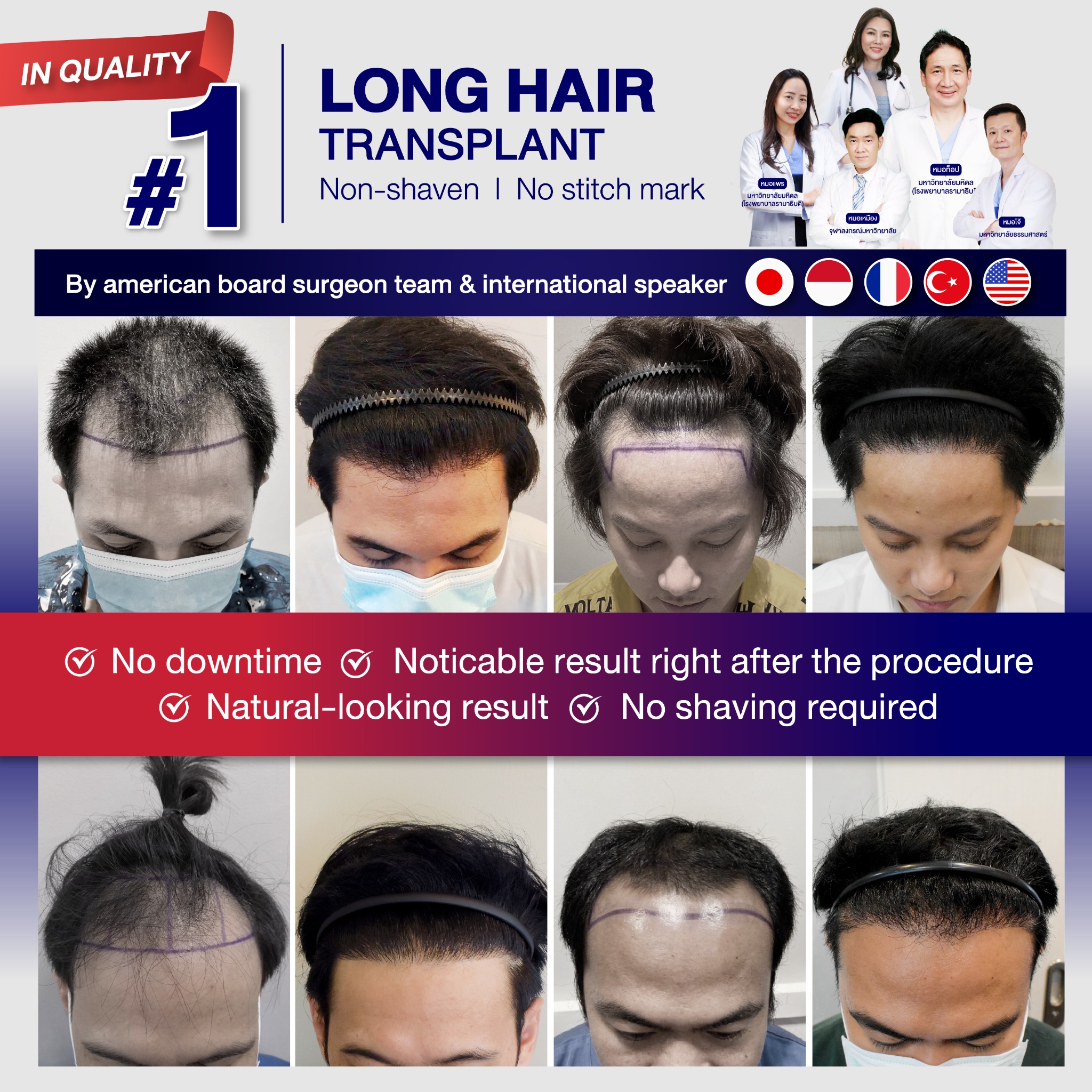 The Skin Clinic International Surgery consultant Facebook ad: Hairline awaits…no shaving required