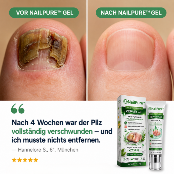Milzie Facebook ad