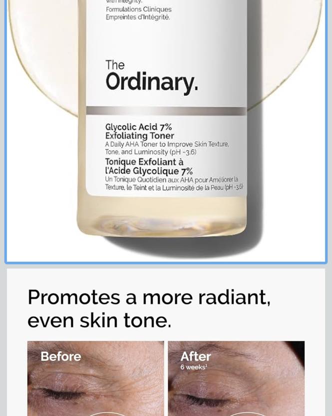 Kitae Blaq Luxe Facebook ad from Feb 28, 2026