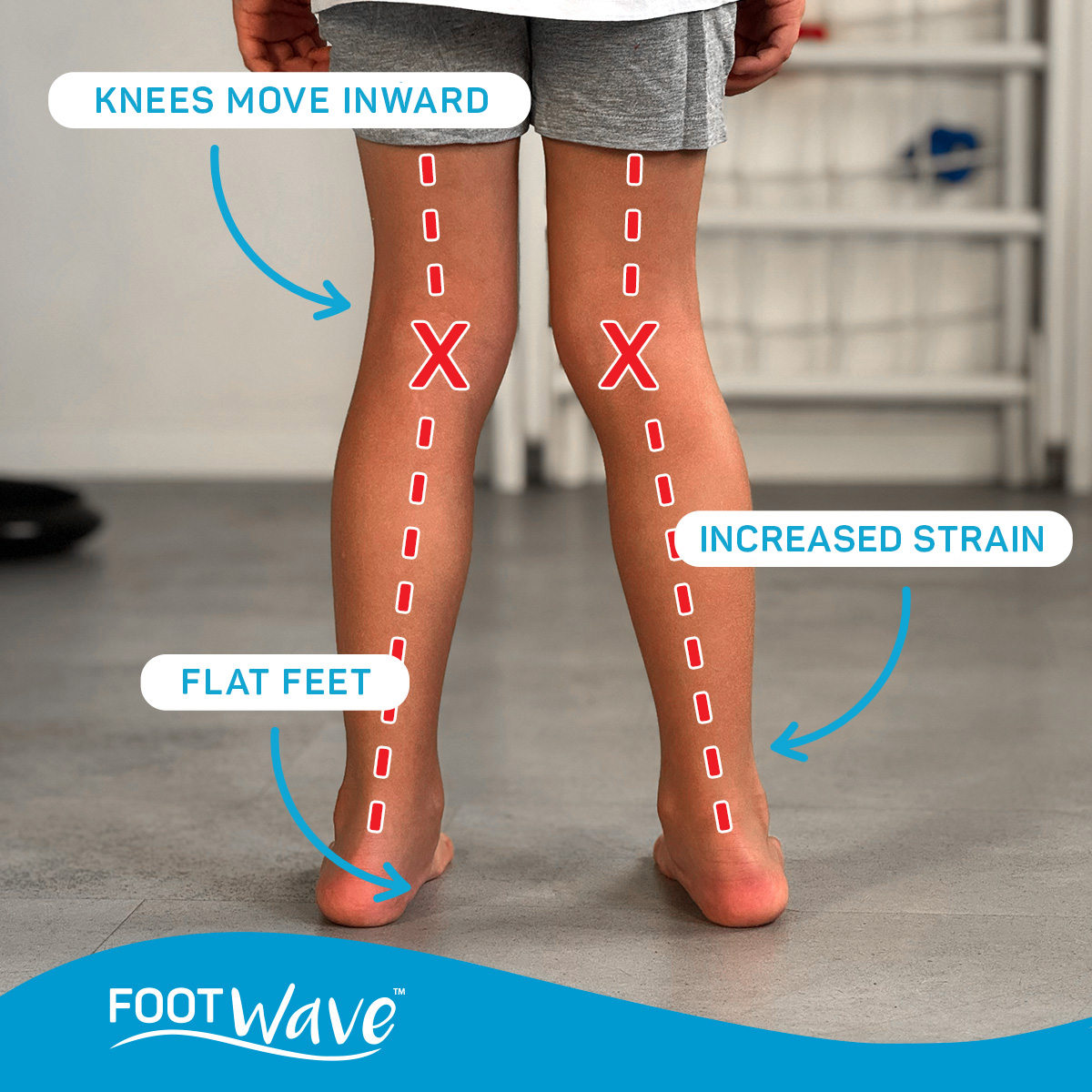 FootWave - dynamic insoles & customizable orthotics Facebook ad