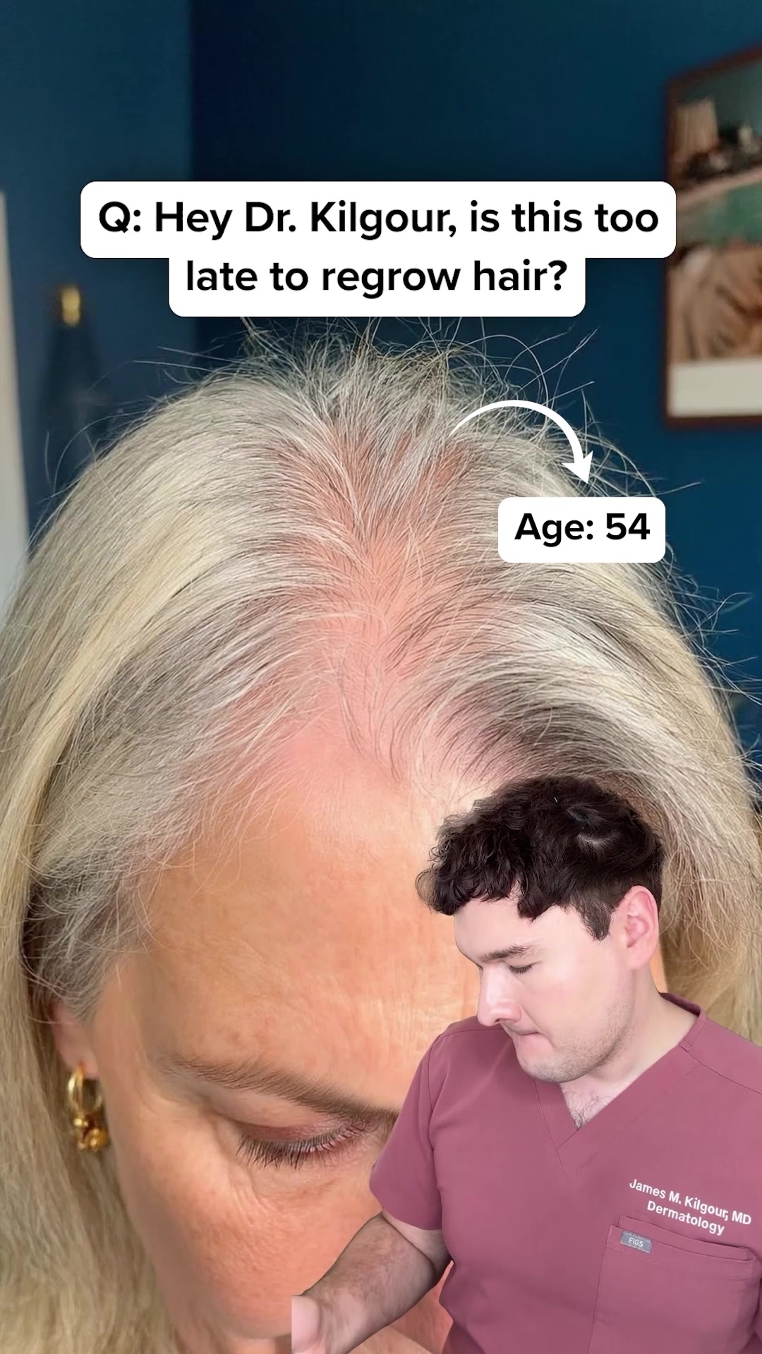 KilgourMD Facebook ad: Scalp trick to to stop menopausal hair loss fast