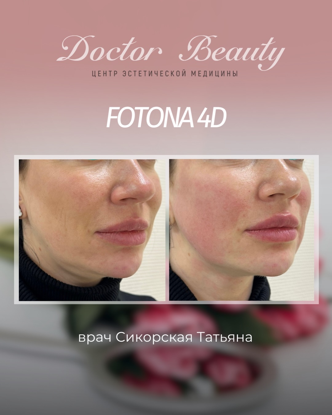 Doctor Beauty Facebook ad: Хотите выглядеть моложе на 7-10 лет всего за…