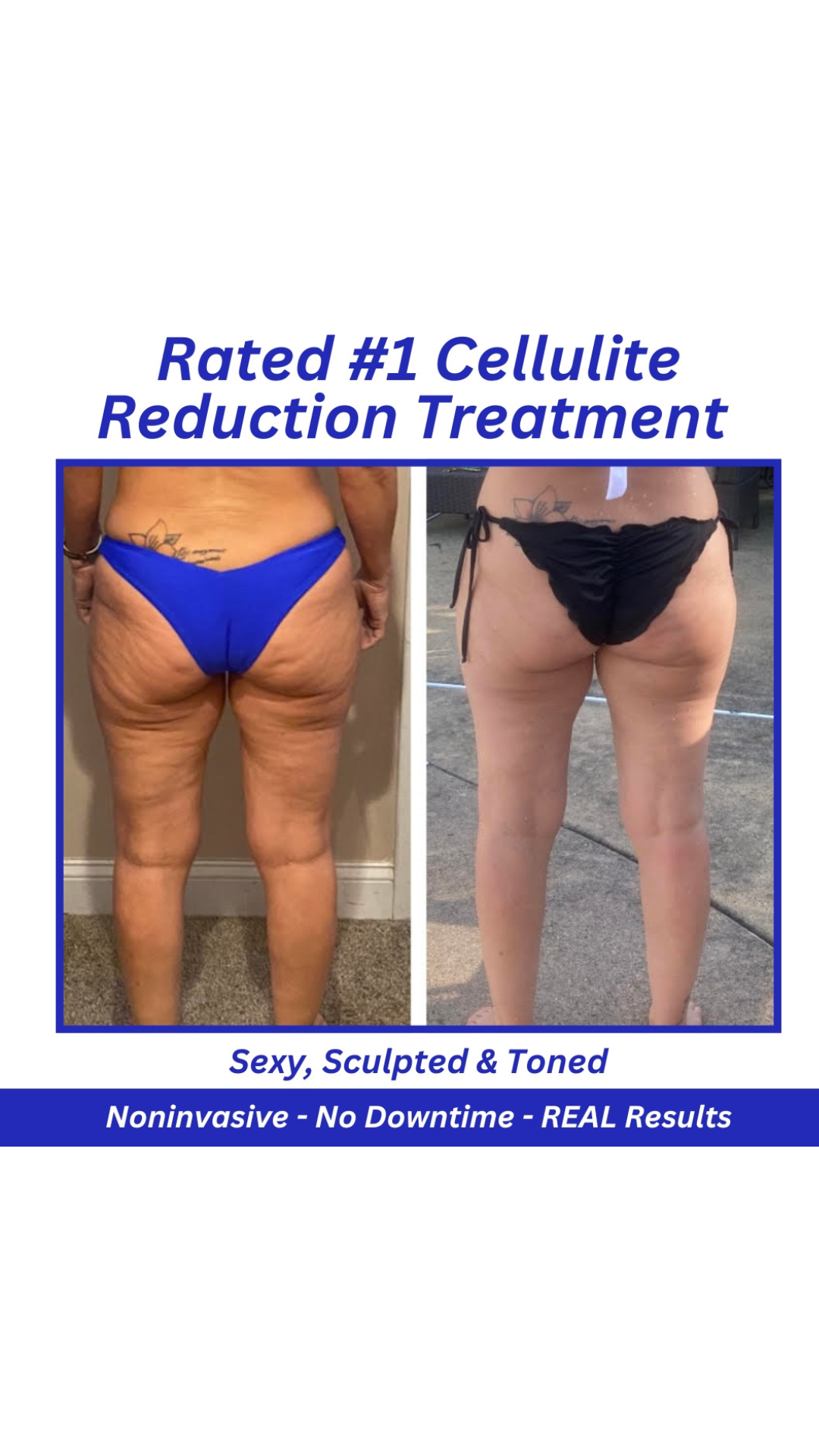 Facial Hewlett NY Facebook ad from Jul 8, 2026