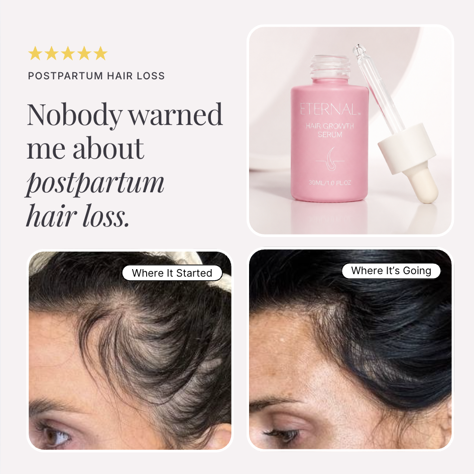 TW Eternal Facebook ad: Nobody told me my hair could come back like this.